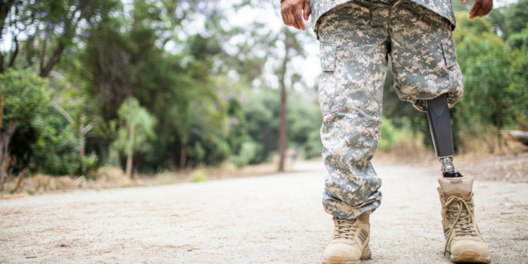 A military member standing with a prosthetic leg visible.